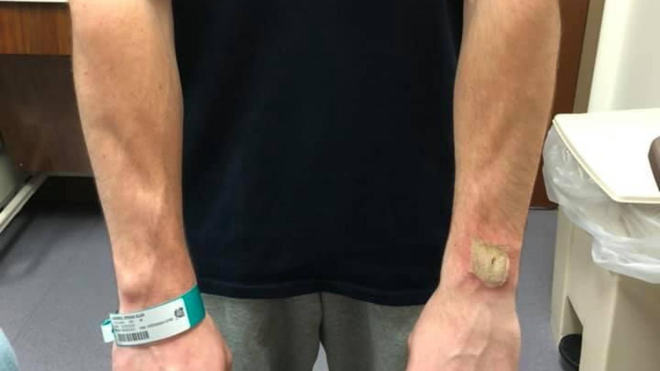 Montre connectée deals douleur bras